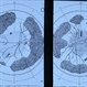 case 2 OD